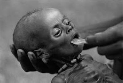 Uganda-1980 - Những bức ảnh gây chấn động cả thế giới! - http://namkna.blogspot.com/