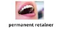 permanent retainer how much do permanent retainers cost