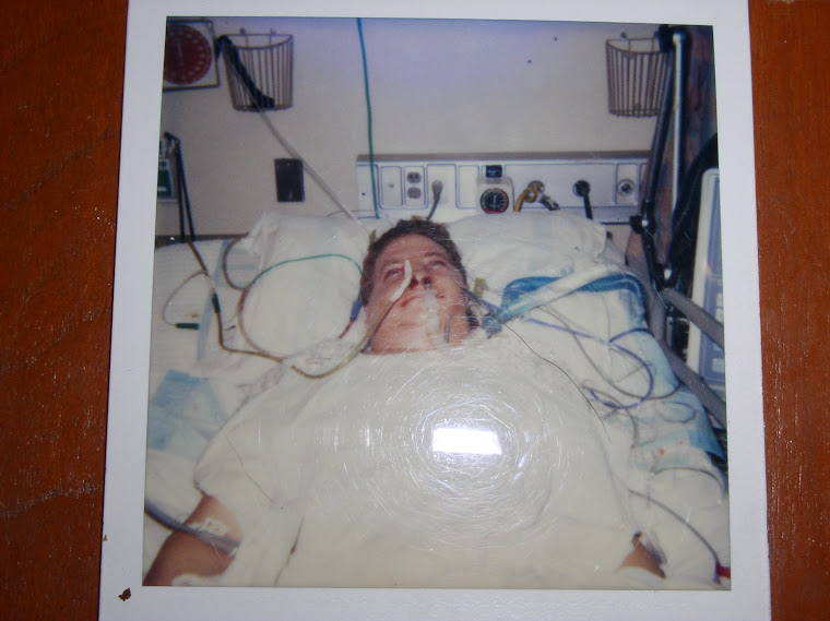 Polaroid on 8/17/1992 in intensive care after reconstructive jaw surgery.