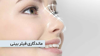 Durability of nose filler