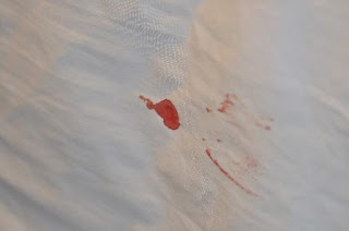 dis-virgin blood in bed sheet stain with blood 