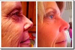 18_Australia testimonial-Stunning Result after using Luminesce[4][4]