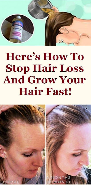 Here’s How To Stop Hair Loss And Grow Your Hair Fast!