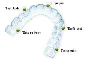 Quy trình niềng răng invisalign