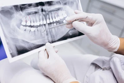 Fim das dentaduras: Cientistas vão testar remédio que faz crescer dentes em adultos - Itiruçu Notícias