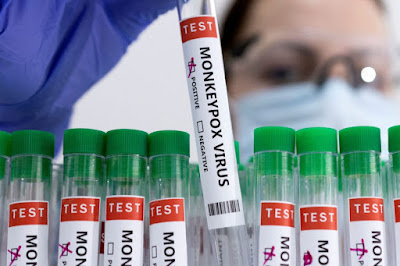 Monkeypox tests