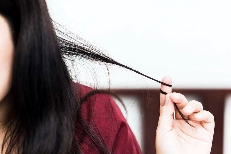 16 Surprising Reasons Your Hair Is Falling Out