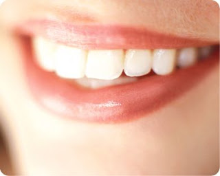 What You Need To Know About Teeth Whitening