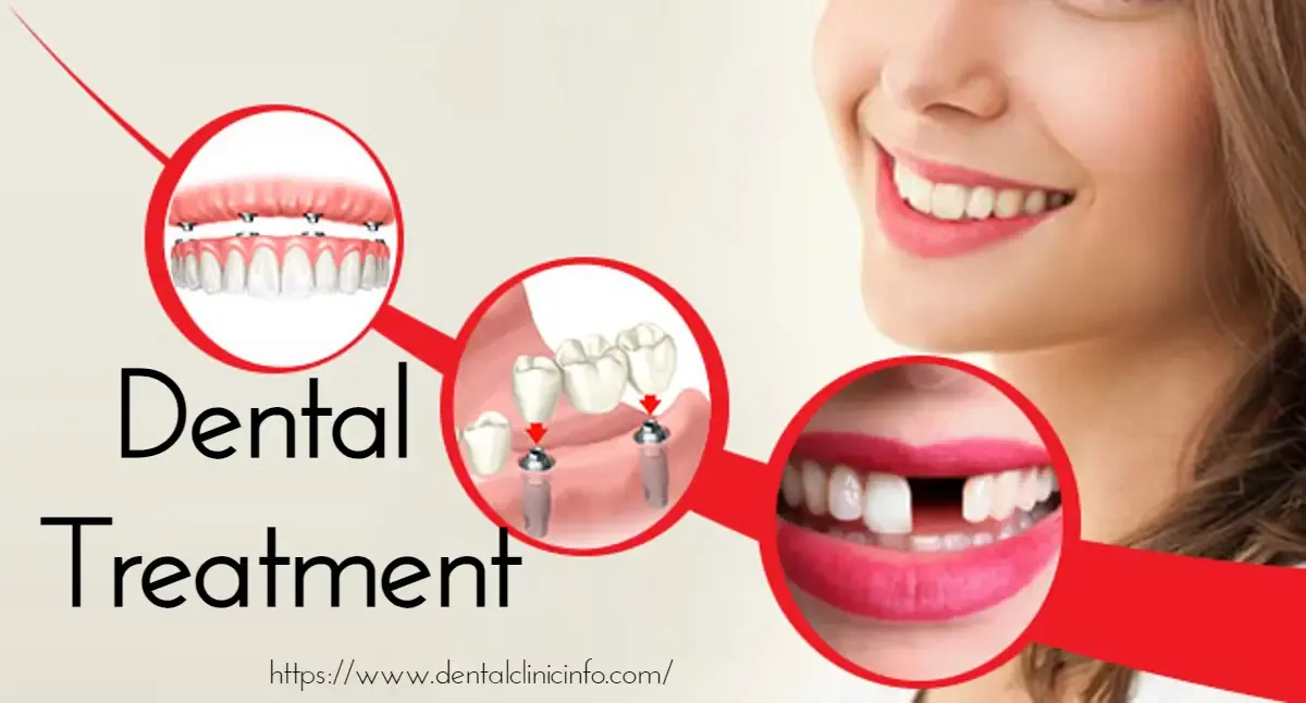 Dental-Treatment-Price-List