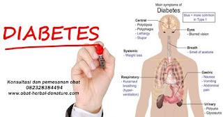 obat diabetes militus,obat herbal diabetes,obat diabetes herbal,cara mengobati diabetes secara herbal,pengobatan diabetes secara herbal,pengobatan diabetes tanpa resep dokter