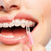 Chảy máu chân răng khi niềng răng có nguy hiểm không?