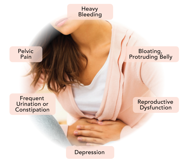 Symptoms for Fibroid 