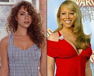 Mariah Carey Breast Implants Before and After