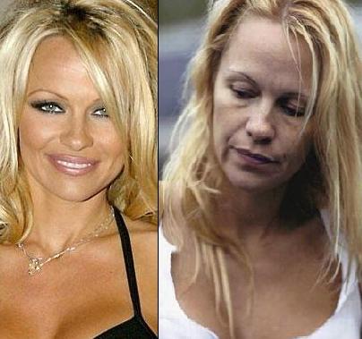 Celebrities Without Makeup Before And