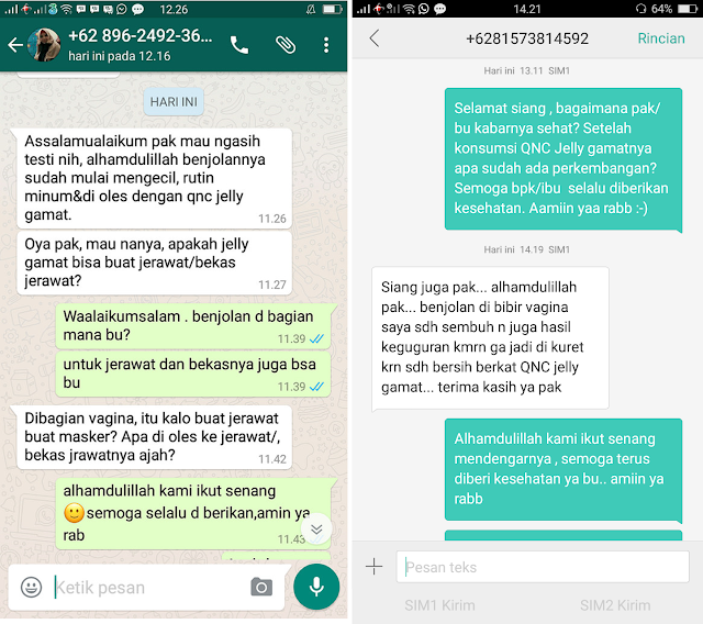 Cara Menghilangkan Benjolan di Paha Kanan