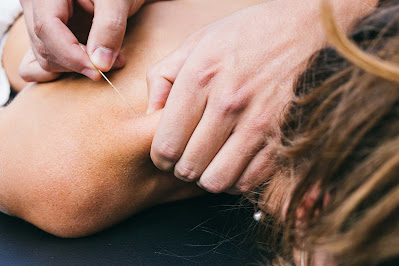 Dry Needling Therapy Brisbane