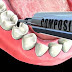 Trám răng composite có bền không? 