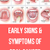 Early Signs & Symptoms of Oral Cancer