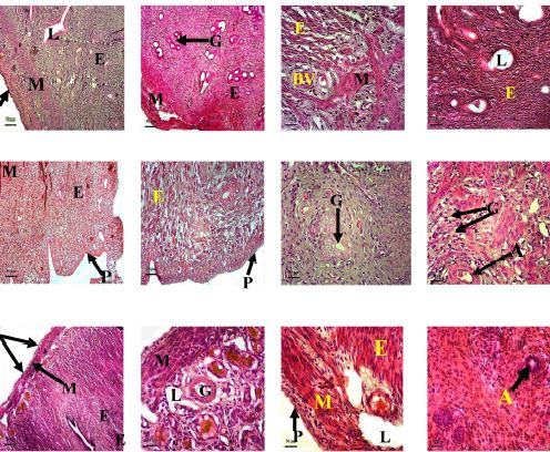Histologic sequelae following exposure to turmeric extract on wistar rats ovary and uterus