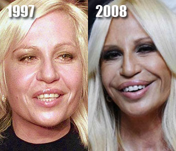 Plastic Surgery Before and After