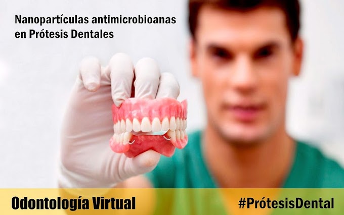 PRÓTESIS DENTAL: ¿Qué efectos tienen las nanopartículas antimicrobioanas en Prótesis Dentales? 