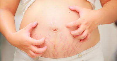 Mẹ bầu cần biết: Những thay đổi thường gặp của làn da trong quá trình mang thai