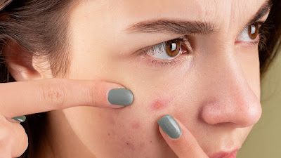 The Dangers of Beauty Products: What are the Harmful Effects of Cosmetics?-allergic reactions