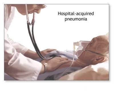 Nosocomial pneumonia 