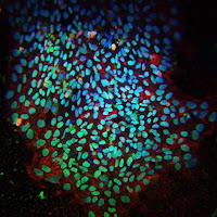 Colony of induced pluripotent stem cells 