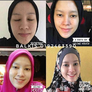 INGINKAN KULIT YANG CANTIK  DAN LEMBUT? IKUTI 6 LANGKAH MUDAH INI