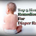 Top 5 Home Remedies For Diaper Rash