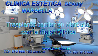 TRASPLANTE CAPILAR MARBELLA Clínica Estética  trasplante capilar para mujeres  y para hombres or en Marbella y Málaga: Te proponemos la alta calidad de servicios con los mejores 