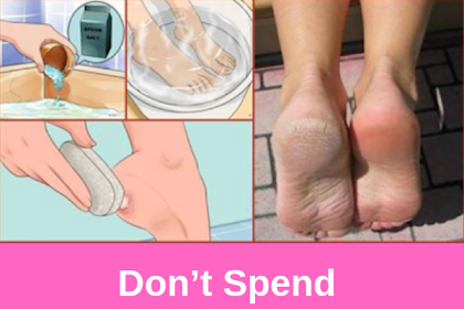 Don’t Spend Your Money On Pedicure: Use Two Ingredients From Your Kitchen and Make Your Feet Look Nice