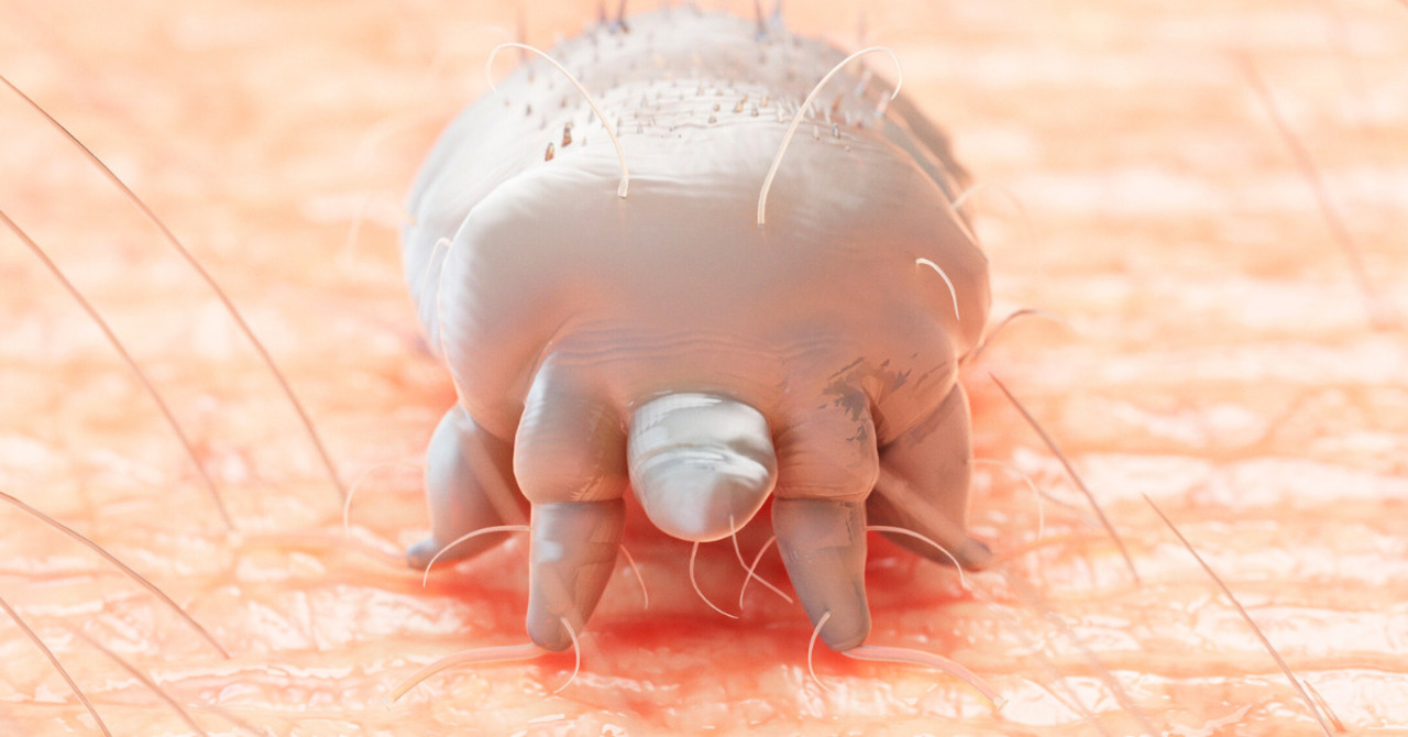 Scabies Tiny mites