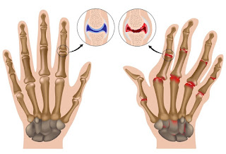 Congenital Orthopedic Disorders