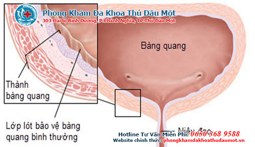 Các nguyên nhân gây nên viêm tuyến tiền liệt