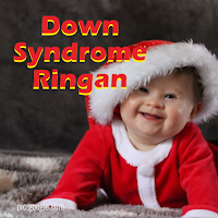 Ciri Down Syndrome Ringan