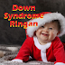 Simak Beberapa Ciri Down Syndrome Ringan Terbaru