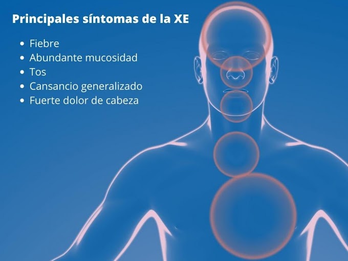 Los síntomas de XE, la nueva variante de covid supercontagiosa