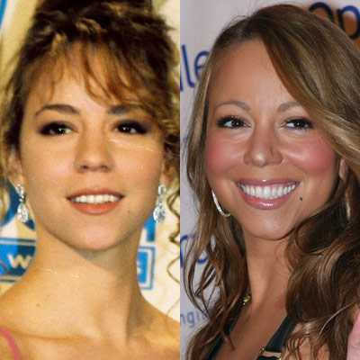Mariah Carey Nose Jobs Before and After