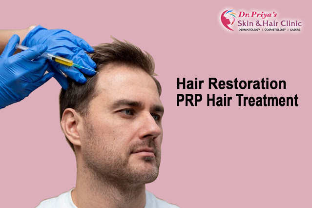 Best PRP Hair Treatment In Bangalore