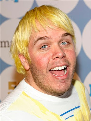 Perez Hilton Acne