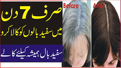 White Hair to Black Permanently in 7 Days Naturally 2017 - Turn white hair to black permanently