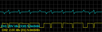 ZX11(ZZR1100) 的正時訊號波型