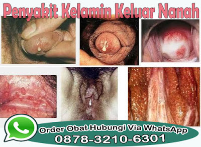 Tips Mengatasi Gejala Penyakit Kencing Nanah