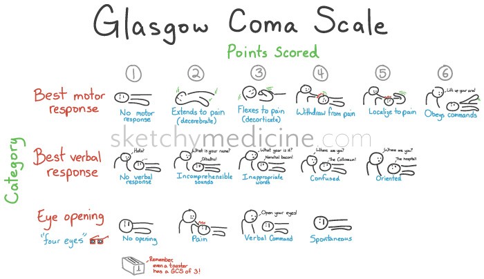 Glasgow Coma Scale GCS  Be a Nurse