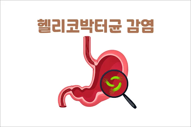 헬리코박터균-감염-경로와-예방-및-치료-방법