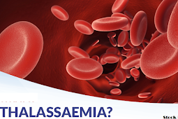 थैलेसीमिया क्या है; इस बीमारी से चुनौतियां (What is Thalassemia; Challenges from this disease)