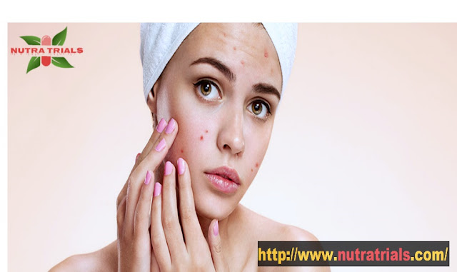 http://www.nutratrials.com/acne-causes-and-treatment-options-to-know/