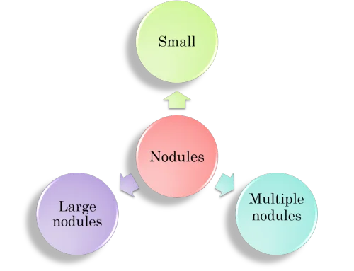 Types of nodules